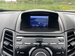 Ford Fiesta 1.6 TDCi Titanium X Euro 5 5dr 5dr Manual 2013